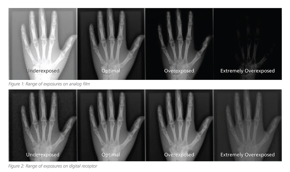 Indicadores de Radiología: La Clave para Controlar la Configuración de la Exposición